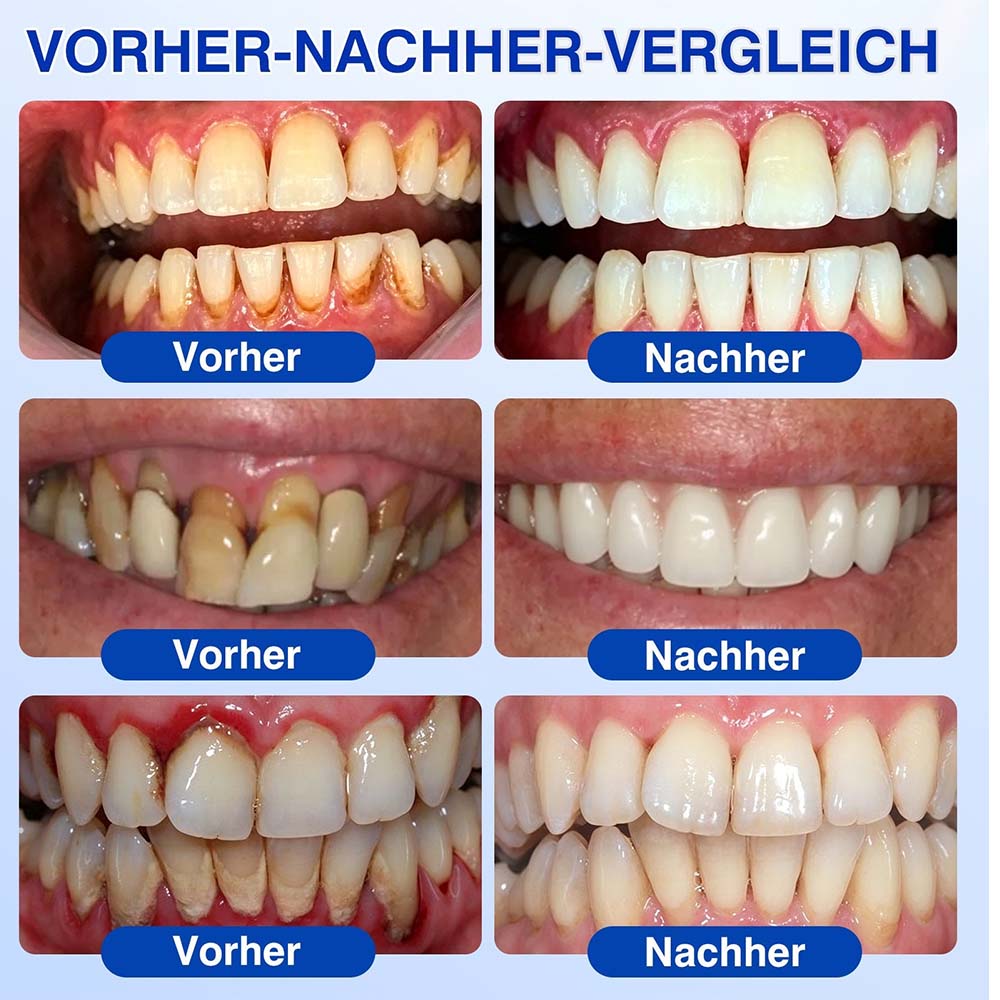 🦷 𝑷𝒖𝒓𝒆𝒍𝒐𝒓𝒂® GumRevive – Gezielte Pflege dort, wo die Zahnbürste kaum hinkommt