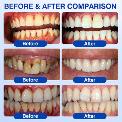 🦷Curalona® GumRevive Periodontal Repair Gel (For Bleeding Gums, Gum Recession & Loose Teeth)