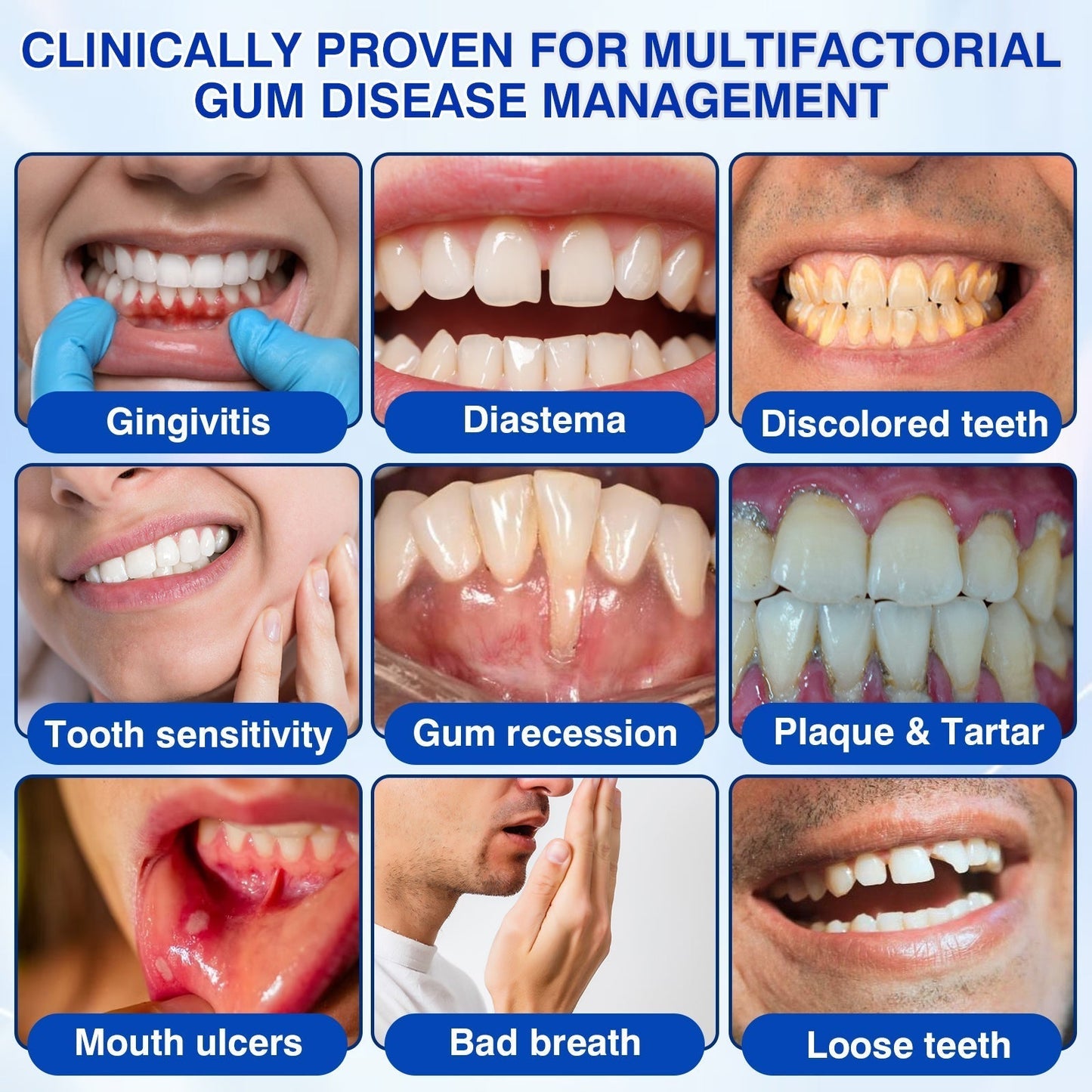 🦷Curalona® GumRevive Periodontal Repair Gel (For Bleeding Gums, Gum Recession & Loose Teeth)