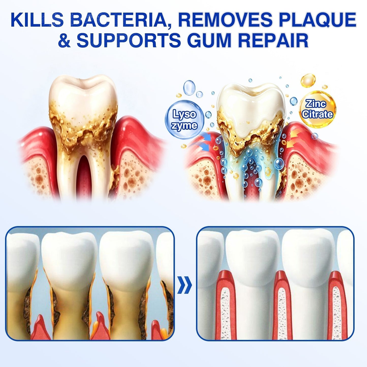 🦷Curalona® GumRevive Periodontal Repair Gel (For Bleeding Gums, Gum Recession & Loose Teeth)