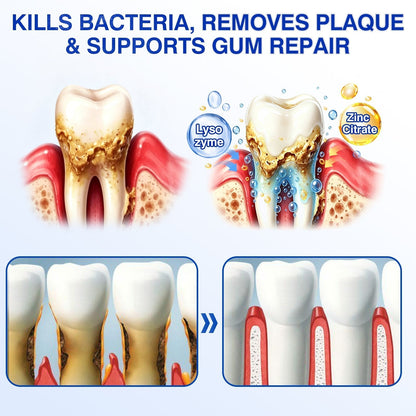 🦷Curalona® GumRevive Periodontal Repair Gel (For Bleeding Gums, Gum Recession & Loose Teeth)