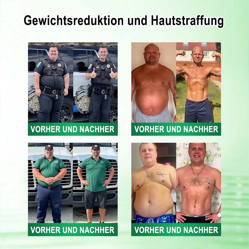 🇩🇪𝐎𝐟𝐟𝐢𝐳𝐢𝐞𝐥𝐥𝐞𝐫 𝐒𝐡𝐨𝐩 | 🏆🏆 𝙋𝙪𝙧𝙚𝙡𝙤𝙧𝙖®𝙈𝙤𝙧𝙞𝙣𝗴𝗮 · 𝗕𝗲𝗿𝗯𝗲𝗿𝒊𝒏 × 𝑵𝘼𝘿+ 10-𝙞𝙣-𝟏 𝐀𝐝𝐯𝐚𝗻𝗰𝗲𝗱 𝗡𝗮𝙣𝙤 𝙈𝙞𝙠𝙧𝐨𝐧𝐚𝐝𝐞𝐥-𝐏𝐚𝒕𝒄𝗵(𝐍𝐮𝐫 𝐞𝐢𝐧𝐦𝐚𝐥 𝐭ä𝐠𝐥𝐢𝐜𝐡, 𝐬𝐢𝐜𝐡𝐭𝐛𝐚𝐫𝐞 𝐕𝐞𝐫ä𝐧𝐝𝐞𝐫𝐮𝐧𝐠𝐞𝐧 𝐢𝐧 𝟕 𝐓𝐚𝐠𝐞𝐧)✅ 𝐅ü𝐫 𝐅𝐞𝐭𝐭𝐥𝐞𝐢𝐛𝐢𝐠𝐤𝐞𝐢𝐭, 𝐇𝐚𝐮𝐭𝐬𝐭𝐫𝐚𝐟𝐟𝐮𝐧𝐠, 𝐃𝐢𝐚𝐛𝐞𝐭𝐞𝐬, 𝐒𝐜𝐡𝐥𝐚𝐟𝐚𝐩𝐧𝐨𝐞, 𝐆𝐞𝐥𝐞𝐧𝐤𝐩𝐫𝐨𝐛𝐥𝐞𝐦𝐞 𝐮𝐧𝐝 𝐦𝐞𝐡𝐫!