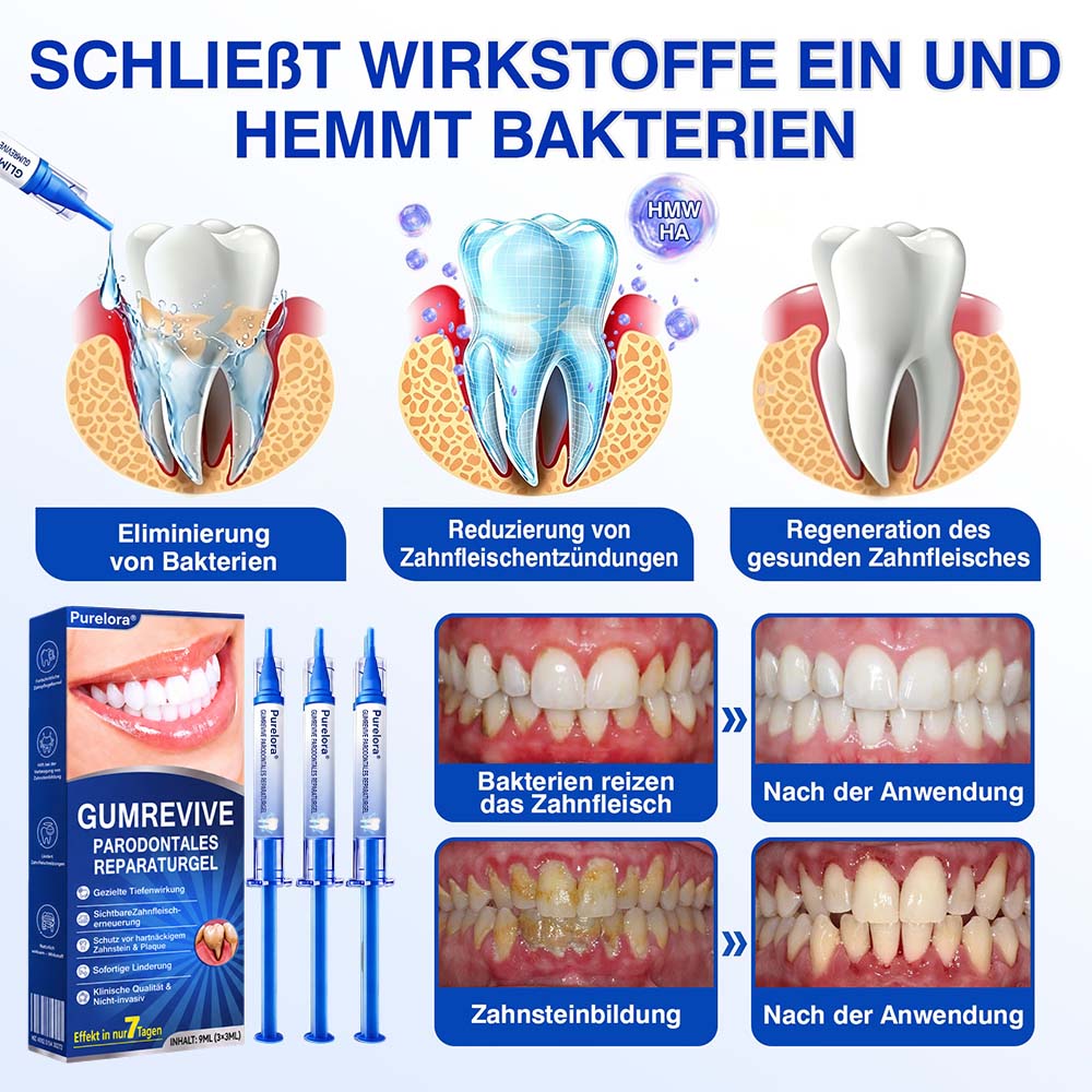 🦷 𝑷𝒖𝒓𝒆𝒍𝒐𝒓𝒂® GumRevive – Gezielte Pflege dort, wo die Zahnbürste kaum hinkommt