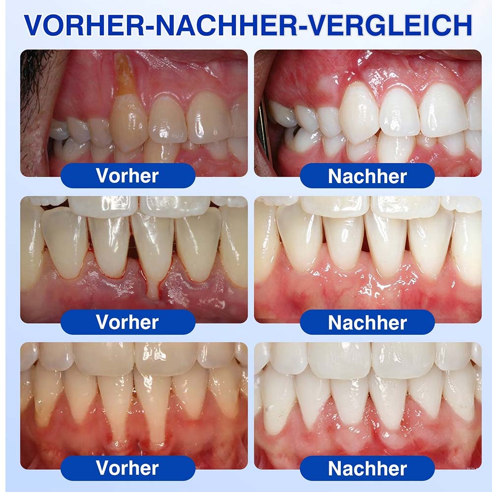 🦷 𝑷𝒖𝒓𝒆𝒍𝒐𝒓𝒂® GumRevive – Gezielte Pflege dort, wo die Zahnbürste kaum hinkommt