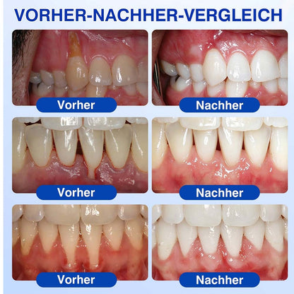🦷 𝑷𝒖𝒓𝒆𝒍𝒐𝒓𝒂® GumRevive – Gezielte Pflege dort, wo die Zahnbürste kaum hinkommt