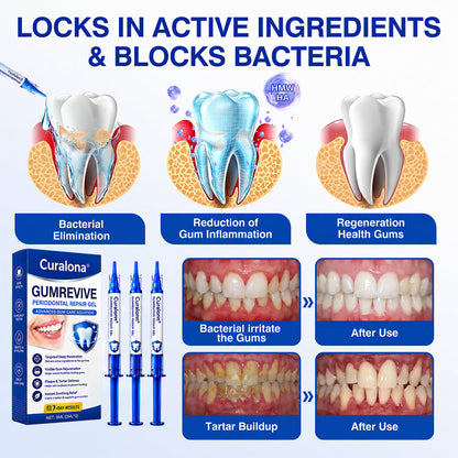 🦷Curalona® GumRevive Periodontal Repair Gel (For Bleeding Gums, Gum Recession & Loose Teeth)